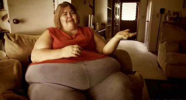 500斤胖女人切皮手术减肥过程!笑称用自己的皮做地毯