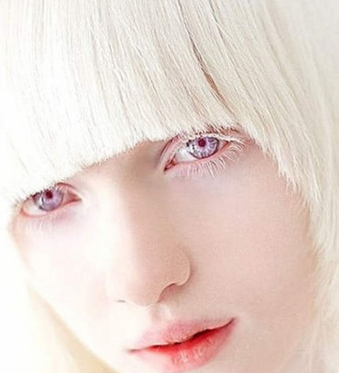 乌克兰最美白化病女孩,她是上帝遗落在人间的天使