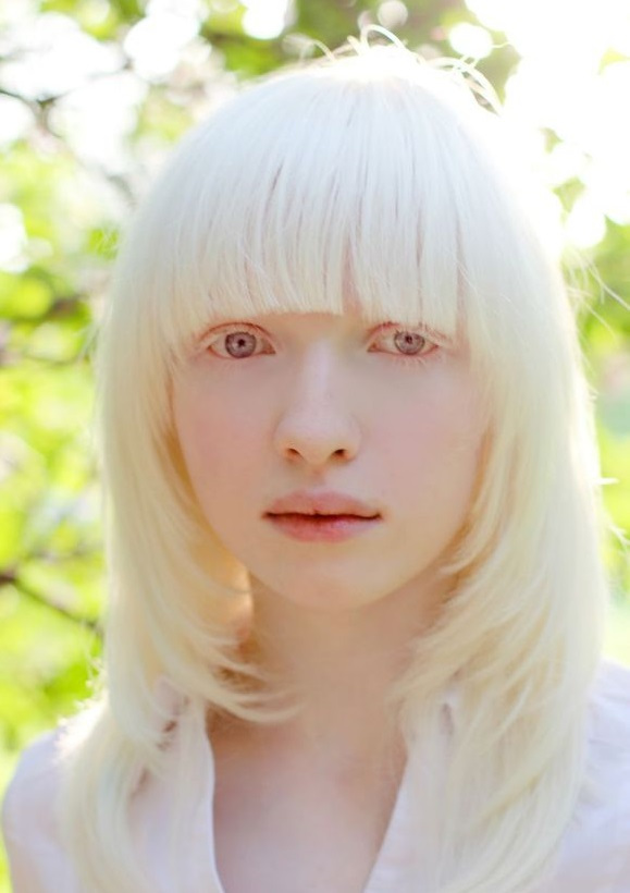 乌克兰颜值最高网红患有白化病,连睫毛,头发都全白