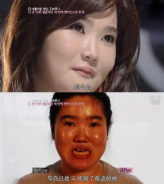 8位韩国丑女整容前后对比照,丑女瞬间变成了大美女