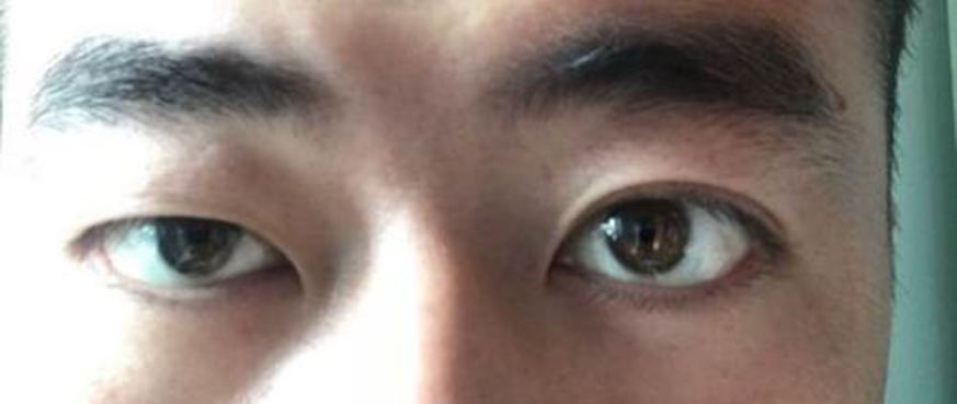 重瞳,雌雄眼,鹰视狼顾,历史上这些面生异相之人