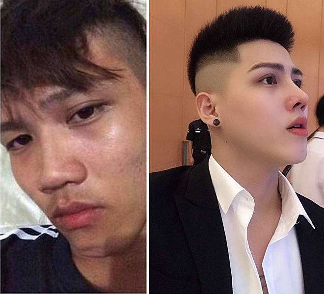 22岁小伙因长得丑被女友抛弃,如今整容成帅哥还当上