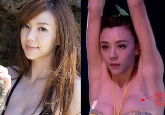 女星隆胸后遗症爆发!假体外露谁的胸最假?