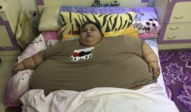 世界上最胖的女人去世,体重达1000斤