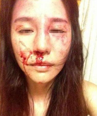 最惨岩女郎,月子期遭老公家暴夺财,为养儿瞒病