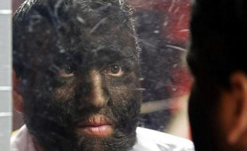 惊:他们不论男女 全身疯狂长毛,似原始人!