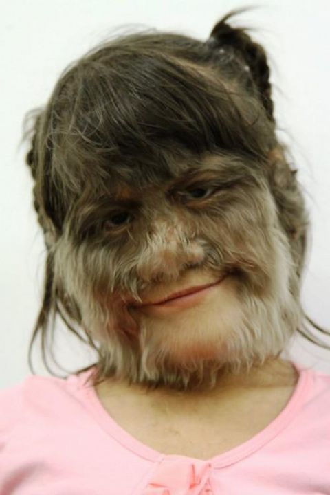 女子屁股竟长出活生生的尾巴!科学家一番解释后,让人吃惊不已!