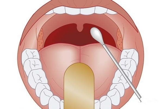 秋天扁桃體容易發炎出現這些症狀千萬不能忽視