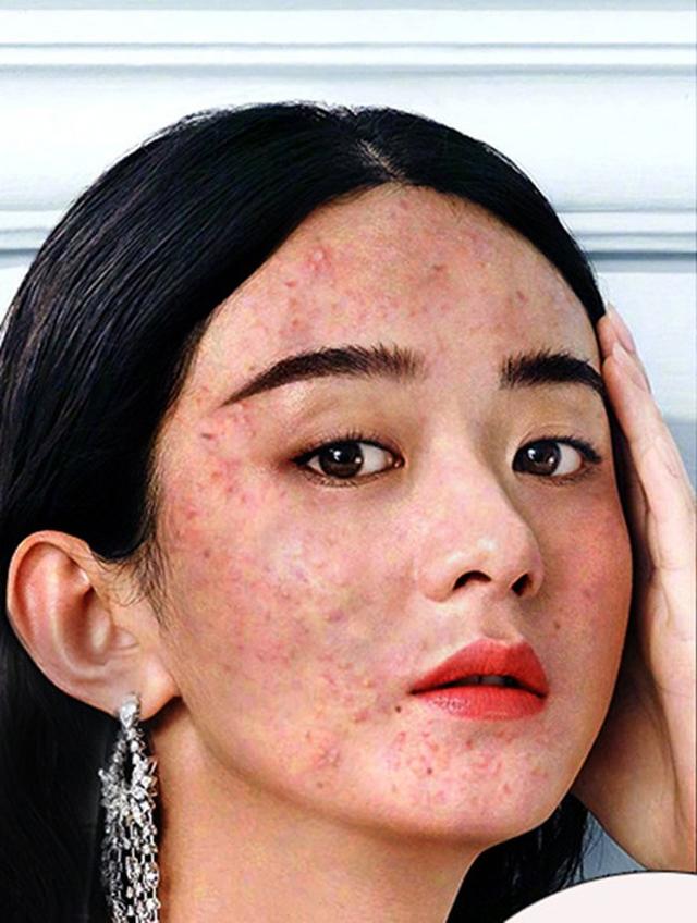 无良商家黑明星图:满脸痱子杨幂赵丽颖迪丽热巴关晓彤谁最丑