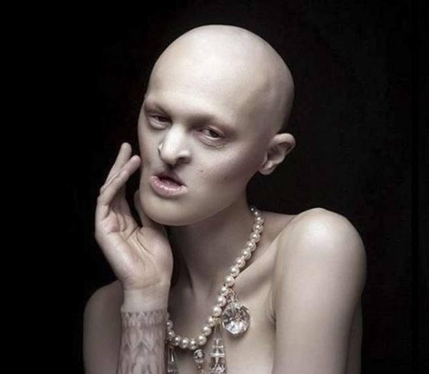 五官萎缩的她从小被人嘲笑如今因外表红遍时尚圈